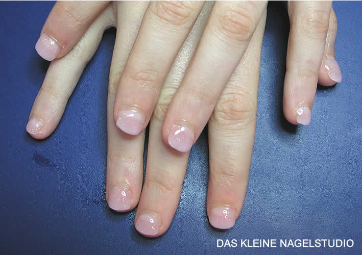 Wie gribok meschpalzewyj auf den Beinen zu heilen